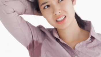 Sudoración excesiva